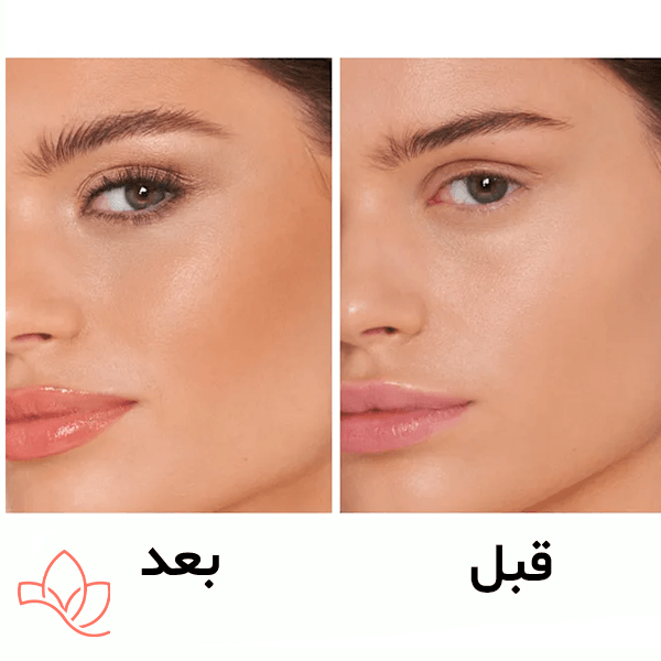 برنزر شارلوت تیلبری