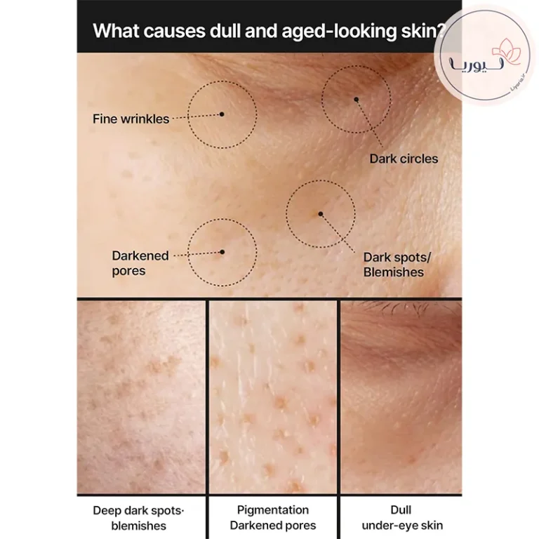 کرم روشن کننده و ضدلک سلیمکس مدل Pore + Dark Spot